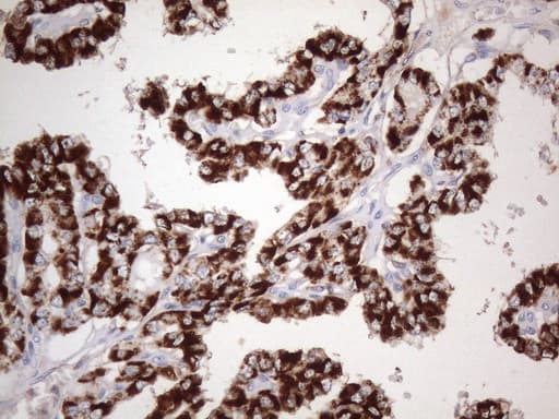 ABAT Antibody (aa29-323, clone UMAB179, Carrier-free)