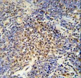 Polyclonal Rabbit anti-Human OTUD4 Antibody (aa403-430, IHC, WB)