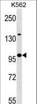 KLHL4 Antibody (aa84-113)