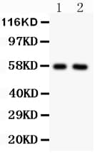 Polyclonal Rabbit anti-Rat ALPL / Alkaline Phosphatase Antibody (aa18-32, WB)