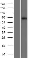 DTX4 Protein (Over-Expression Lysate Myc-DDK (Flag))