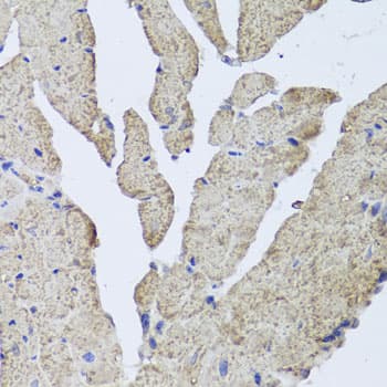 Polyclonal Rabbit anti-Human HBA1+2 / Hemoglobin Alpha Antibody (IHC, WB)