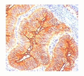 TAG-72 Antibody (clone CA72/733)