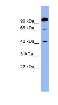 NTSR1 / NTR Antibody (aa35-84)