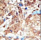 EPHB1 / EPH Receptor B1 Antibody (aa955-984)