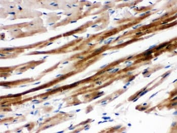 Polyclonal Rabbit anti-Human PTPN11 / SHP-2 / NS1 Antibody (IHC, WB)