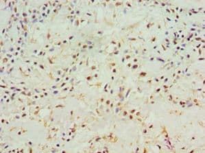 Polyclonal Rabbit anti-Human ACY1 / Aminoacylase 1 Antibody (aa1-408, IHC, WB)