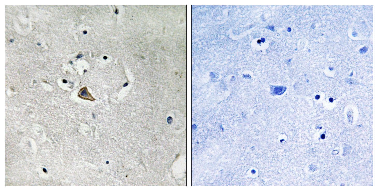 Polyclonal Rabbit anti-Human EMA / MUC1 Antibody (Ab-1227, IHC)