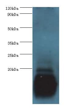 PVALB / Parvalbumin Antibody (aa2-110)