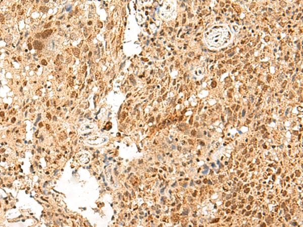 PD2 / PAF1 Antibody