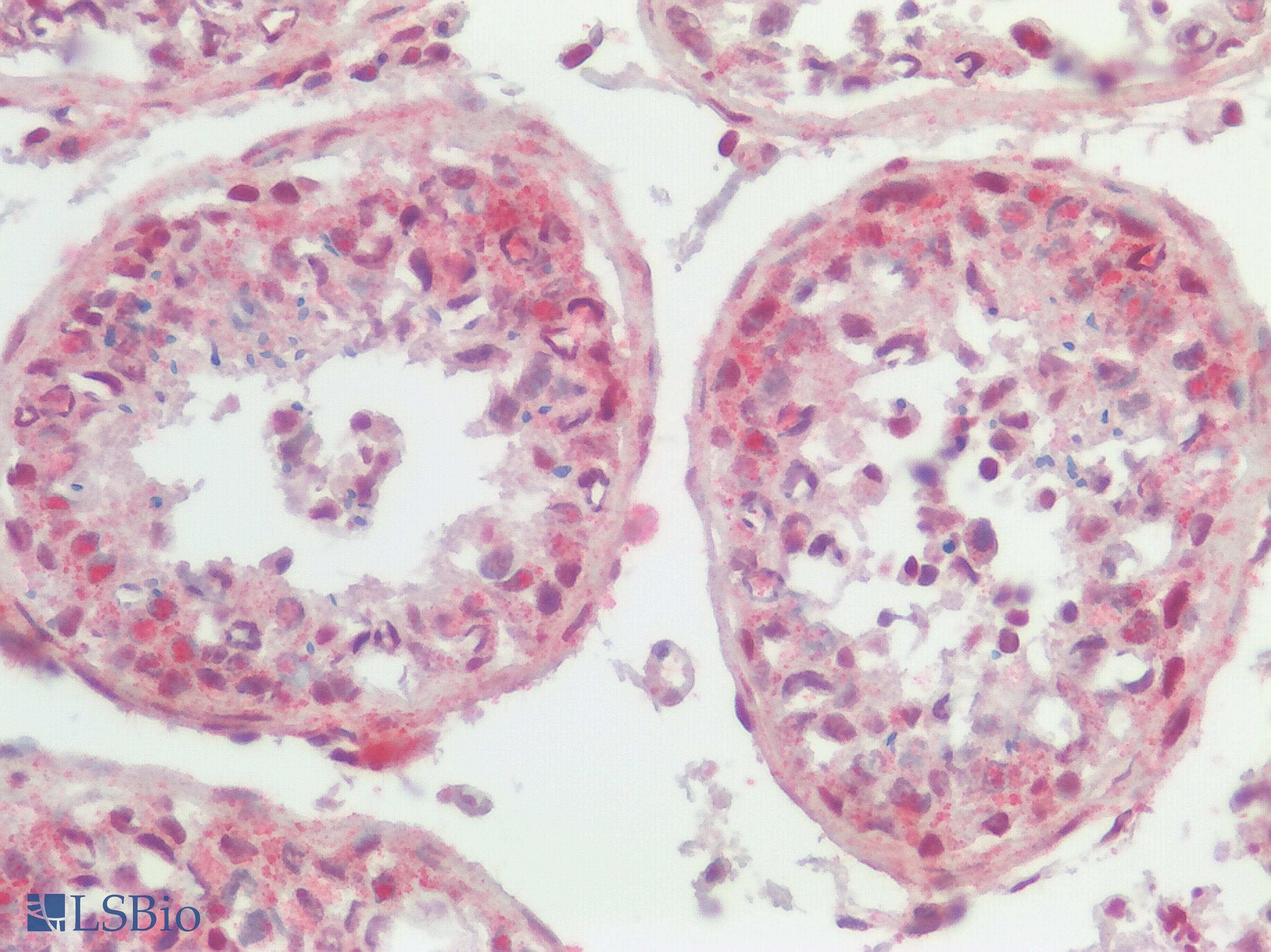 IHC-plus™ SSTR2 Antibody (Extracellular Domain)