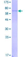 Human ACP2 / Acid Phosphatase 2 Protein (Recombinant GST)