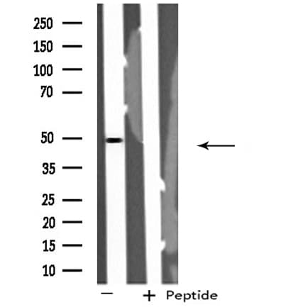 Polyclonal Rabbit anti-Human STK24 / MST3 Antibody (IHC, WB)