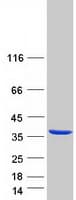 Human NOSIP Protein (Recombinant Myc-DDK (Flag))