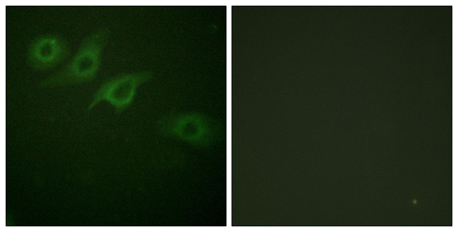 CD119 / IFNGR1 Antibody (p457)