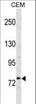 Polyclonal Rabbit anti-Human MTHFR Antibody (aa266-292, WB)