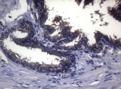 Monoclonal Mouse anti-Human FOXO3 / FOXO3A Antibody (clone OTI5F11, aa374-673, IHC, WB)