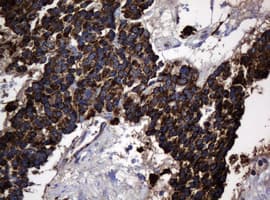 HSPD1 / HSP60 Antibody (clone OTI3G1)