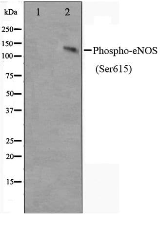 NOS3 / eNOS Antibody (phospho-Ser615)