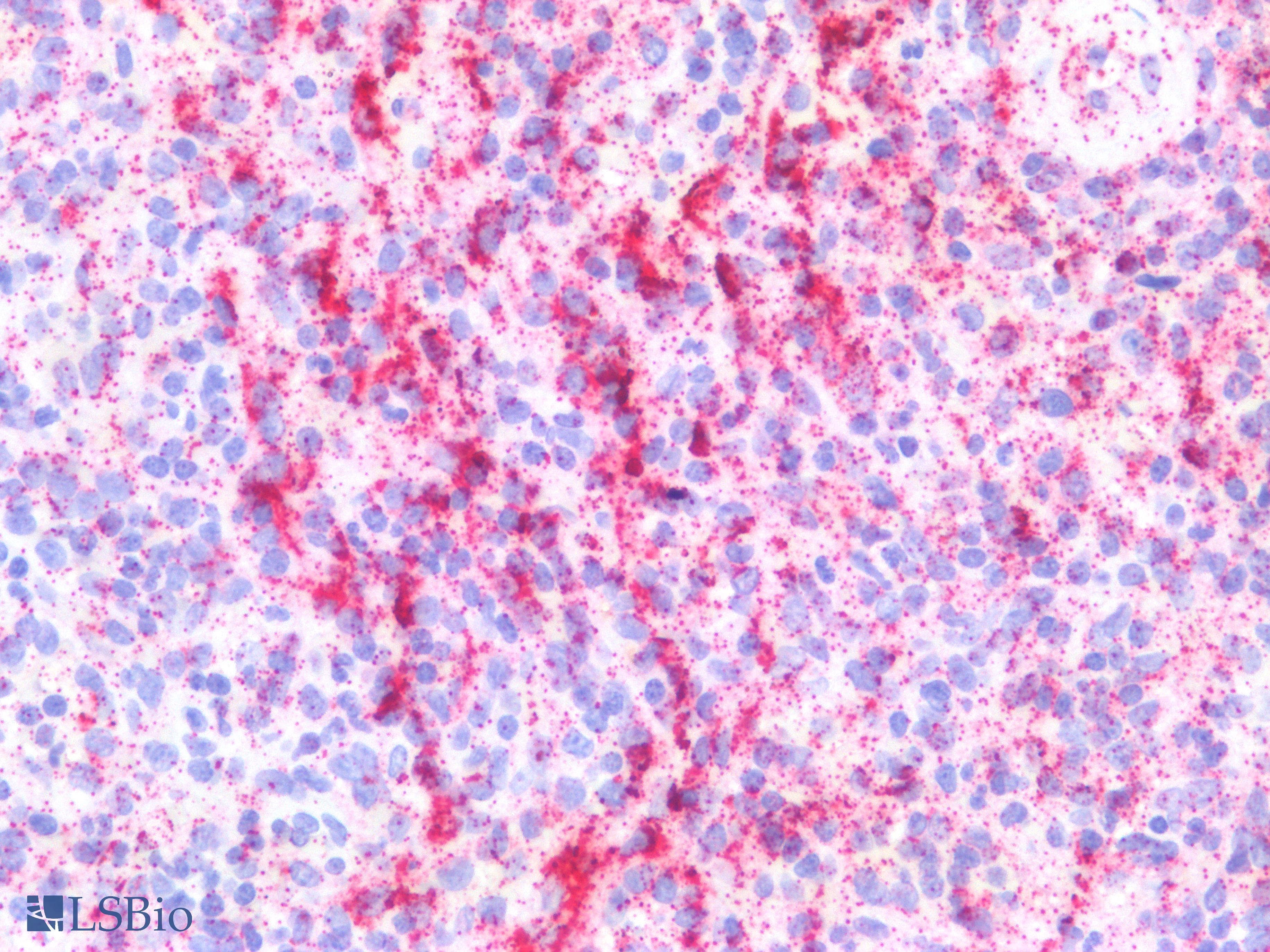 PathPlus™ IL17A Antibody