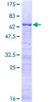 Human CBX7 Protein (Recombinant GST)