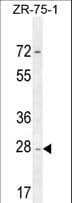 Polyclonal Rabbit anti-Human NDUFAF1 / CIA30 Antibody (aa247-276, IHC, WB)