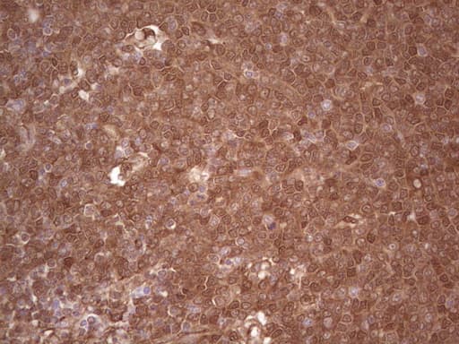 LGALS9 / Galectin 9 Antibody (clone OTI1D12)