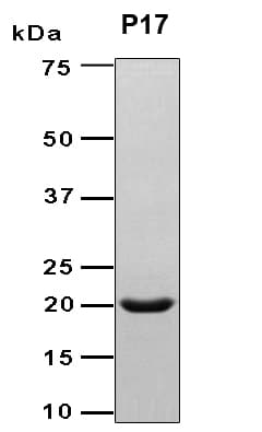 Brucella abortus DMRL synthase 2 Protein (Recombinant 6His, N-terminus)