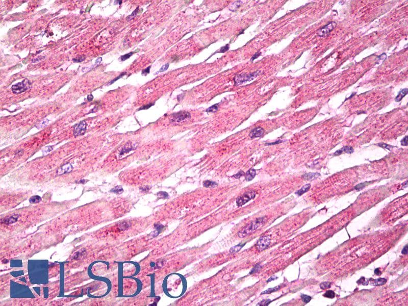 IHC-plus™ Polyclonal Rabbit anti-Human EPM2A / Laforin Antibody (aa80-130, IHC, WB)