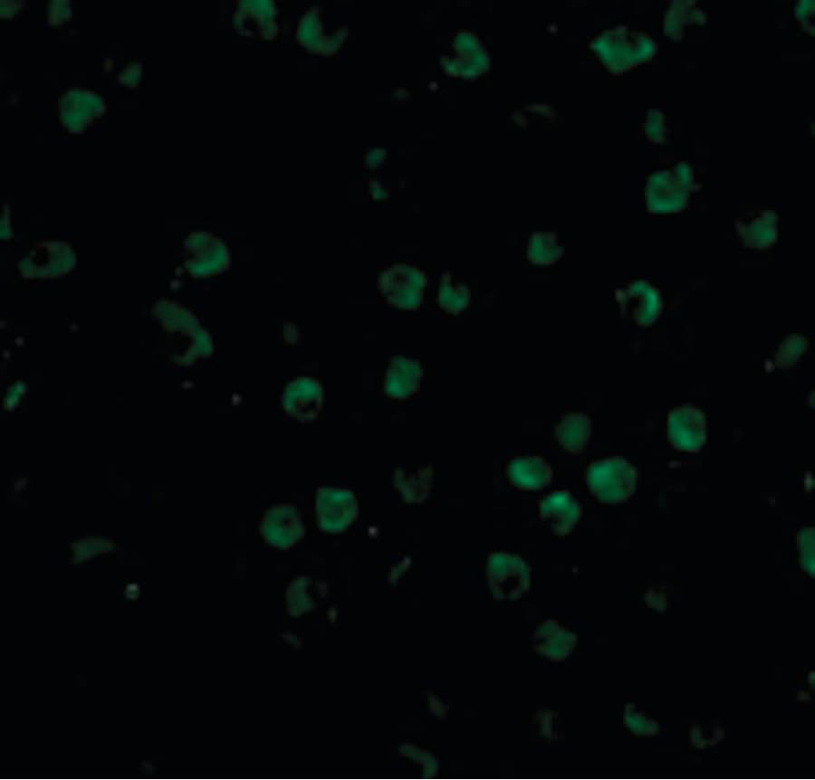 IHC-plus™ Polyclonal Rabbit anti-Human TNFRSF14 / CD270 / HVEM Antibody (IHC, IF, WB)