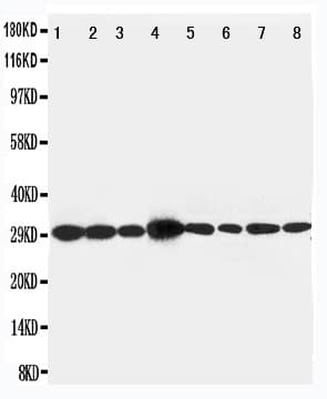 LASP1 Antibody (aa16-30)
