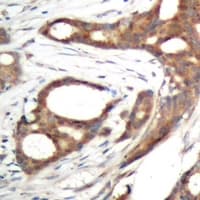 Polyclonal Rabbit anti-Human PER2 Antibody (phospho-Ser662, IHC, WB)