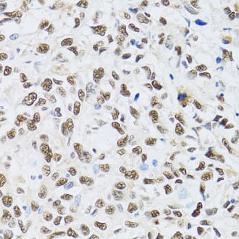 MTA3 Antibody