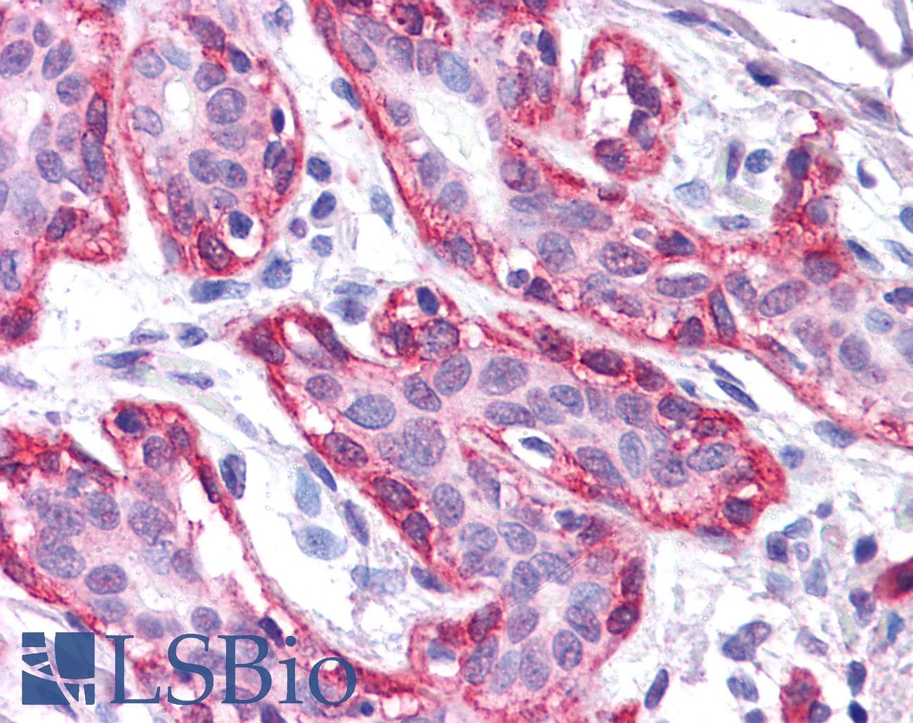 IHC-plus™ FRK Antibody (clone 1A8H2C12)