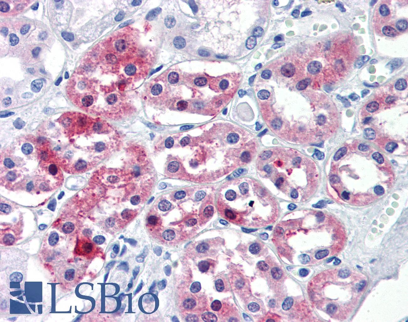 IHC-plus™ Polyclonal Rabbit anti-Human OLFM4 / Olfactomedin 4 Antibody (Internal)