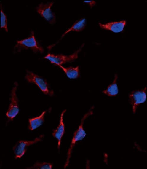 Polyclonal Rabbit anti-Human KITLG / SCF Antibody (aa244-273, IF, WB)