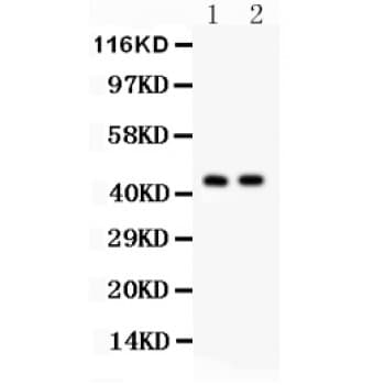 CTH / Cystathionase Antibody (aa181-398)