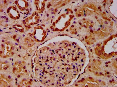 HIST1H3A Antibody