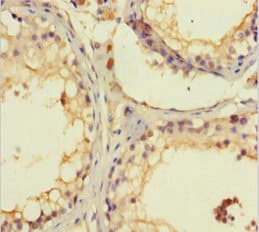 C1orf111 Antibody