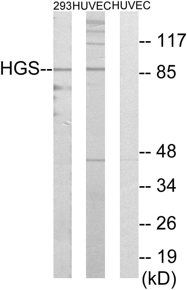Polyclonal Rabbit anti-Human HRS / HGS Antibody (IHC, IF, WB)