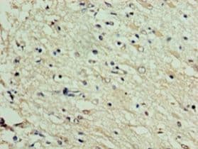DNAJC30 Antibody (FITC)