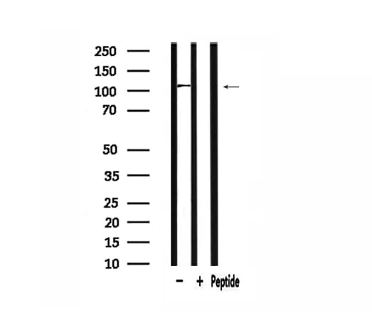 ATXN2L Antibody