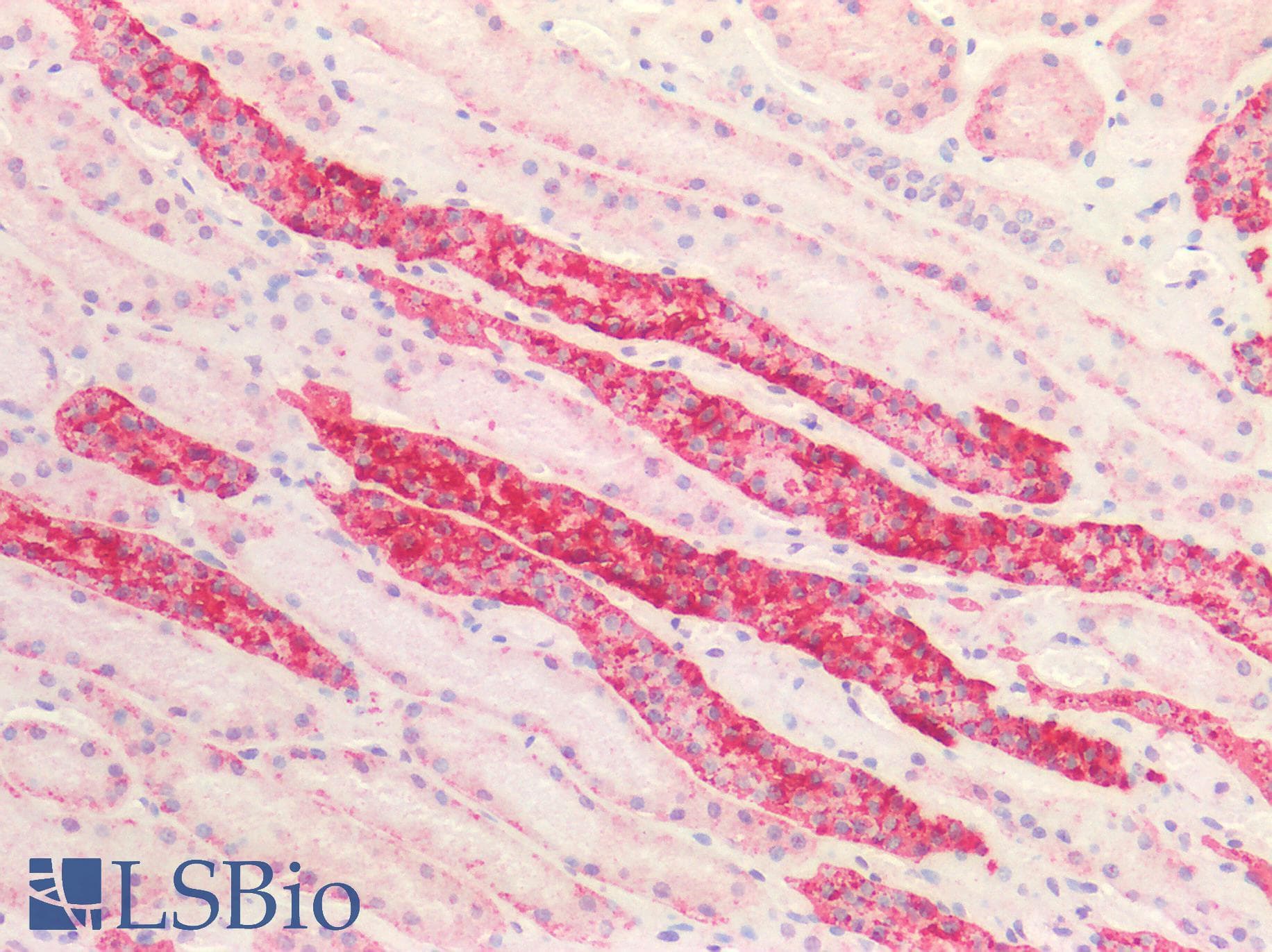 PathPlus™ TTR / Transthyretin Antibody