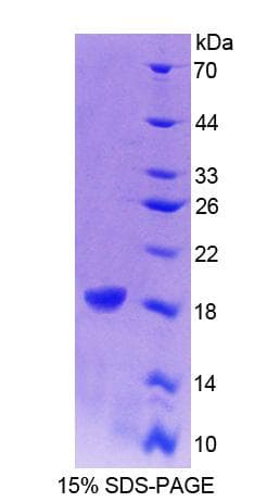Human CRABP1 / CRABP Protein (Recombinant His-T7)