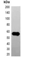 GFP Tag Antibody