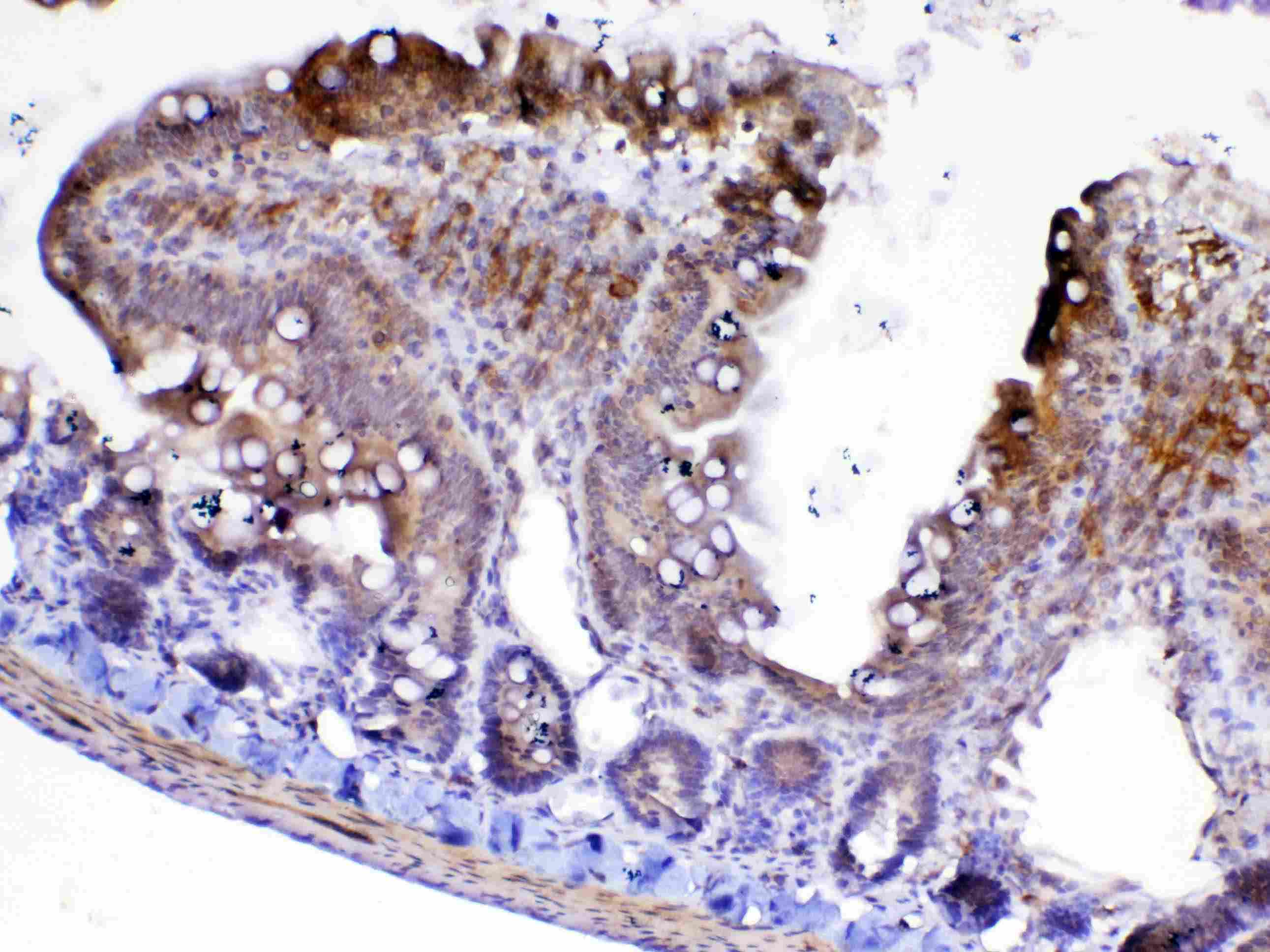 CFD / Factor D / Adipsin Antibody