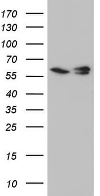 Monoclonal Mouse anti-Human RAD23B / HR23B Antibody (clone OTI7F11, aa1-253, WB)