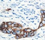 Monoclonal Mouse anti-Human CA 15-3 Antibody (clone DF3, IHC)