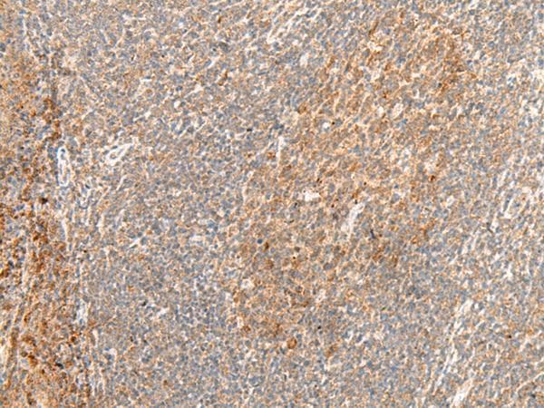 Polyclonal Rabbit anti-Human GPR62 Antibody (IHC, WB)