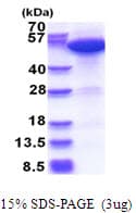 Human ERO1A / ERO1L Protein (Recombinant His)